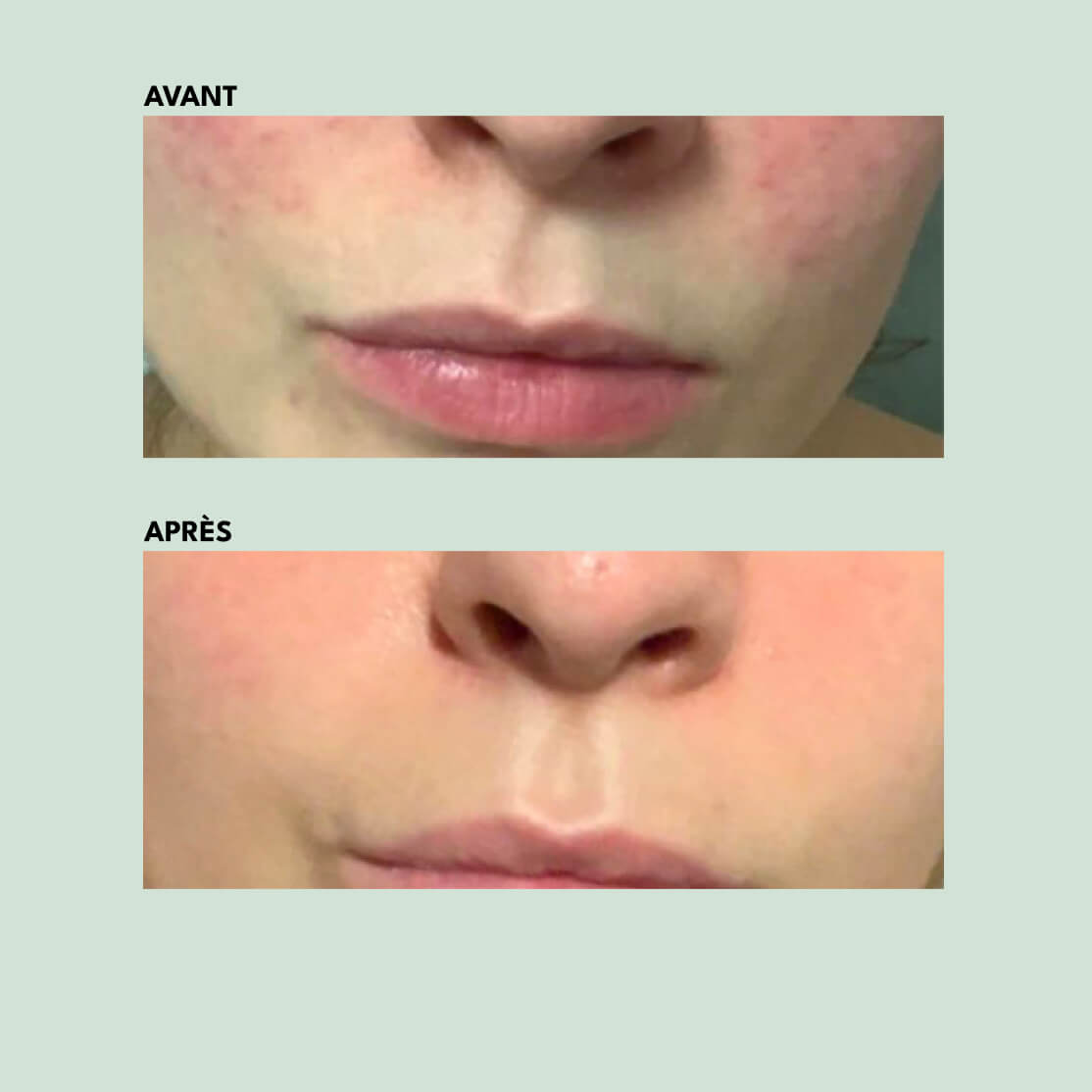 Crème Légère - Anti-Imperfections | 30ml