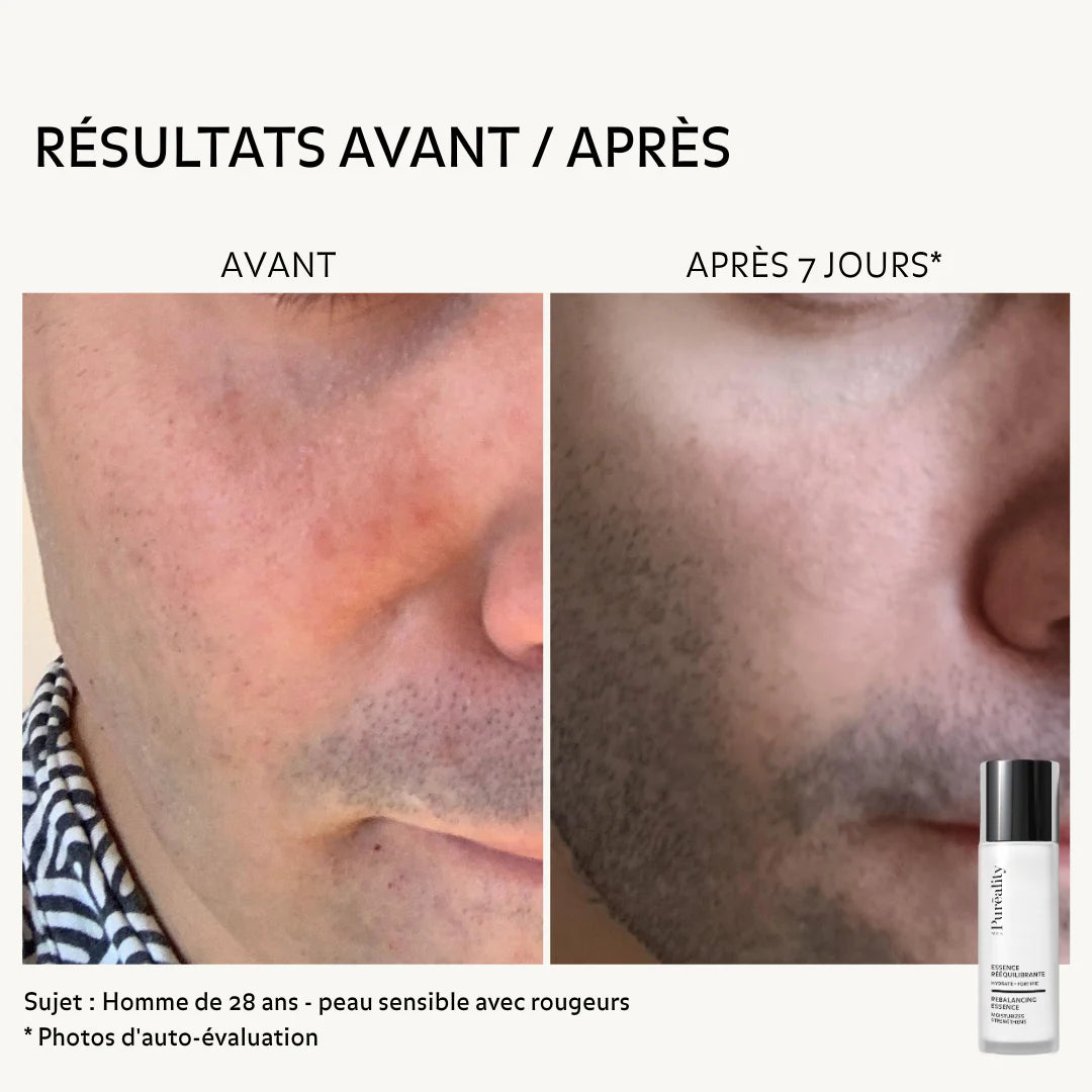 Essence Rééquilibrante