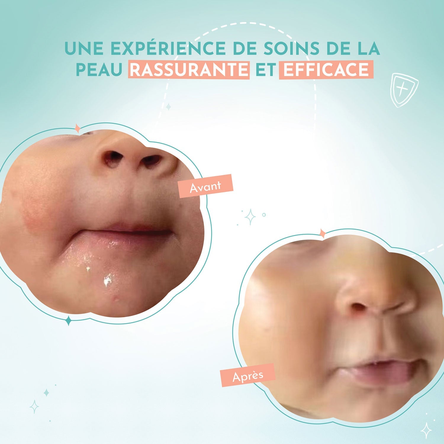Kit Soin Réparateur "Pour rêver" • Crème DOUTOPIA + Boîtier Féérique