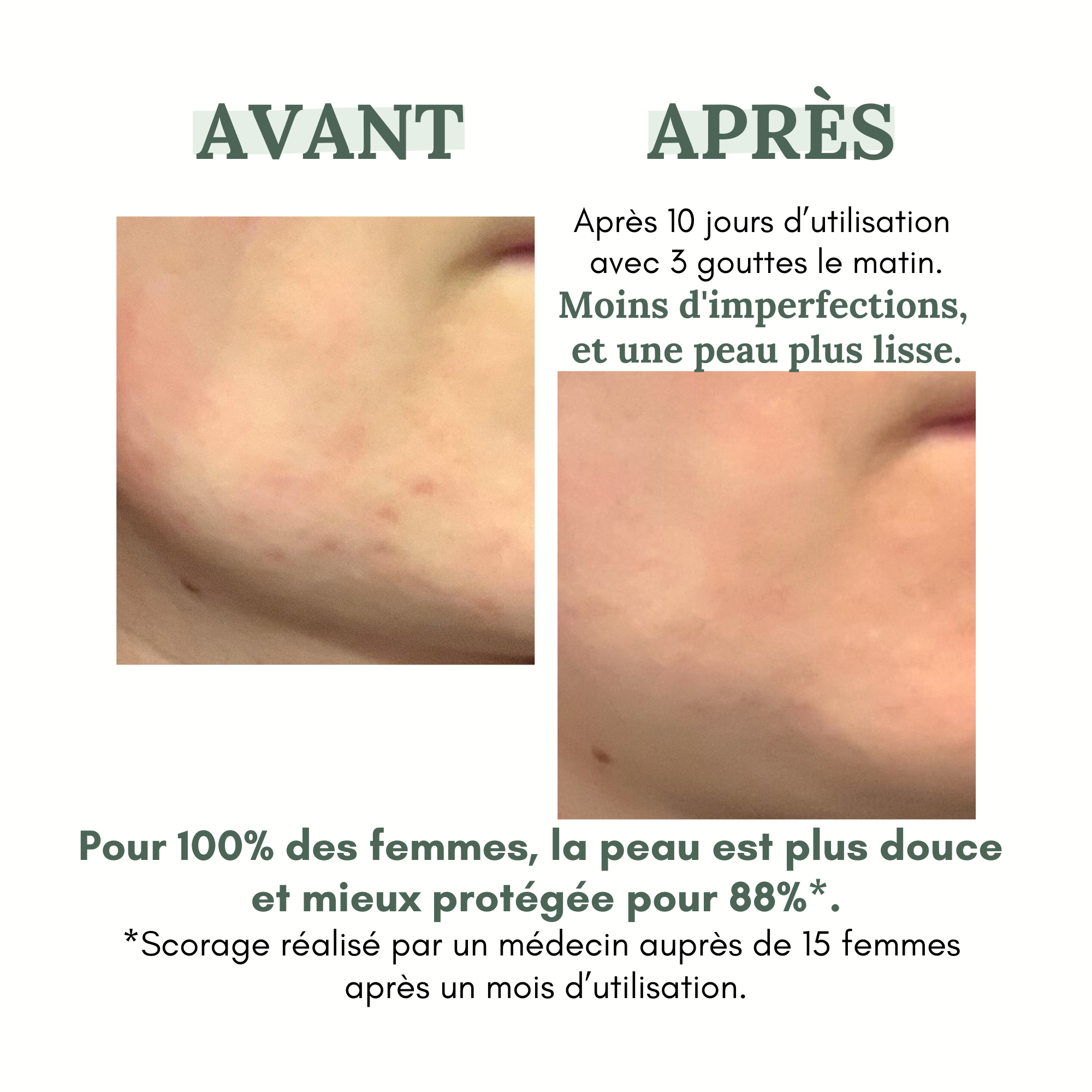 Sérum anti-imperfections DAY