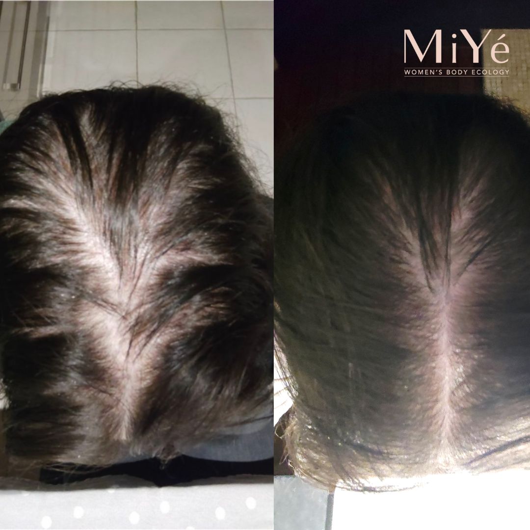 [MY] Sérum Cheveux Densifiant Anti-Chute