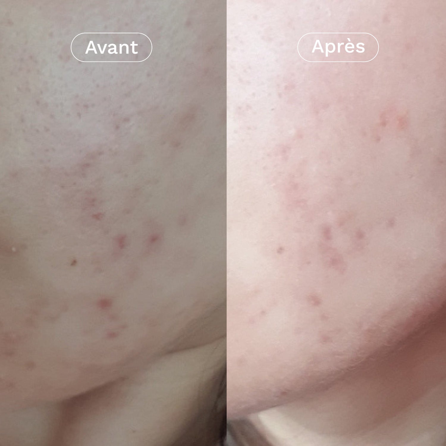 Crème visage rééquilibrante & hydratante aux prébiotiques Ma Jolie Peau