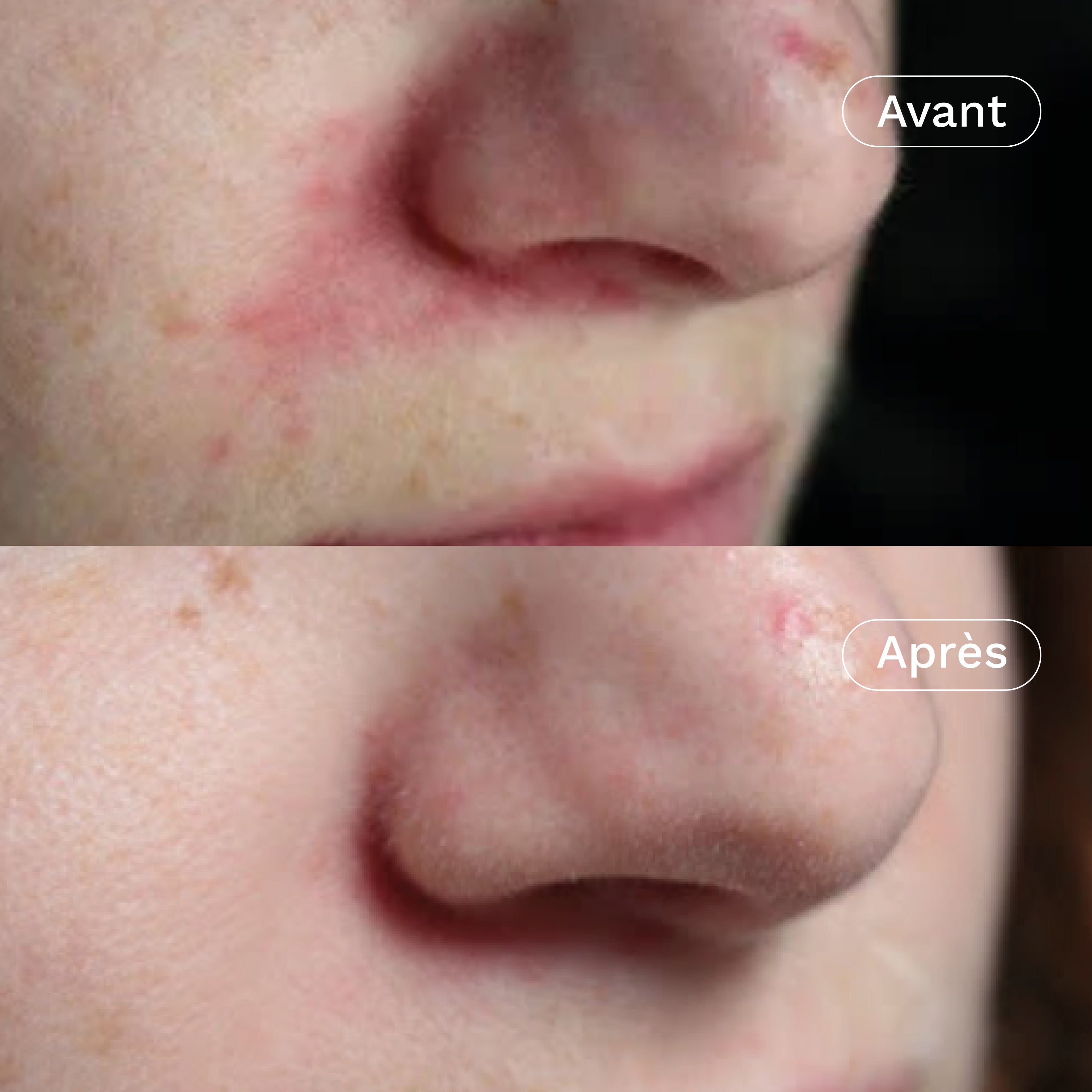 Crème visage rééquilibrante & hydratante aux prébiotiques Ma Jolie Peau