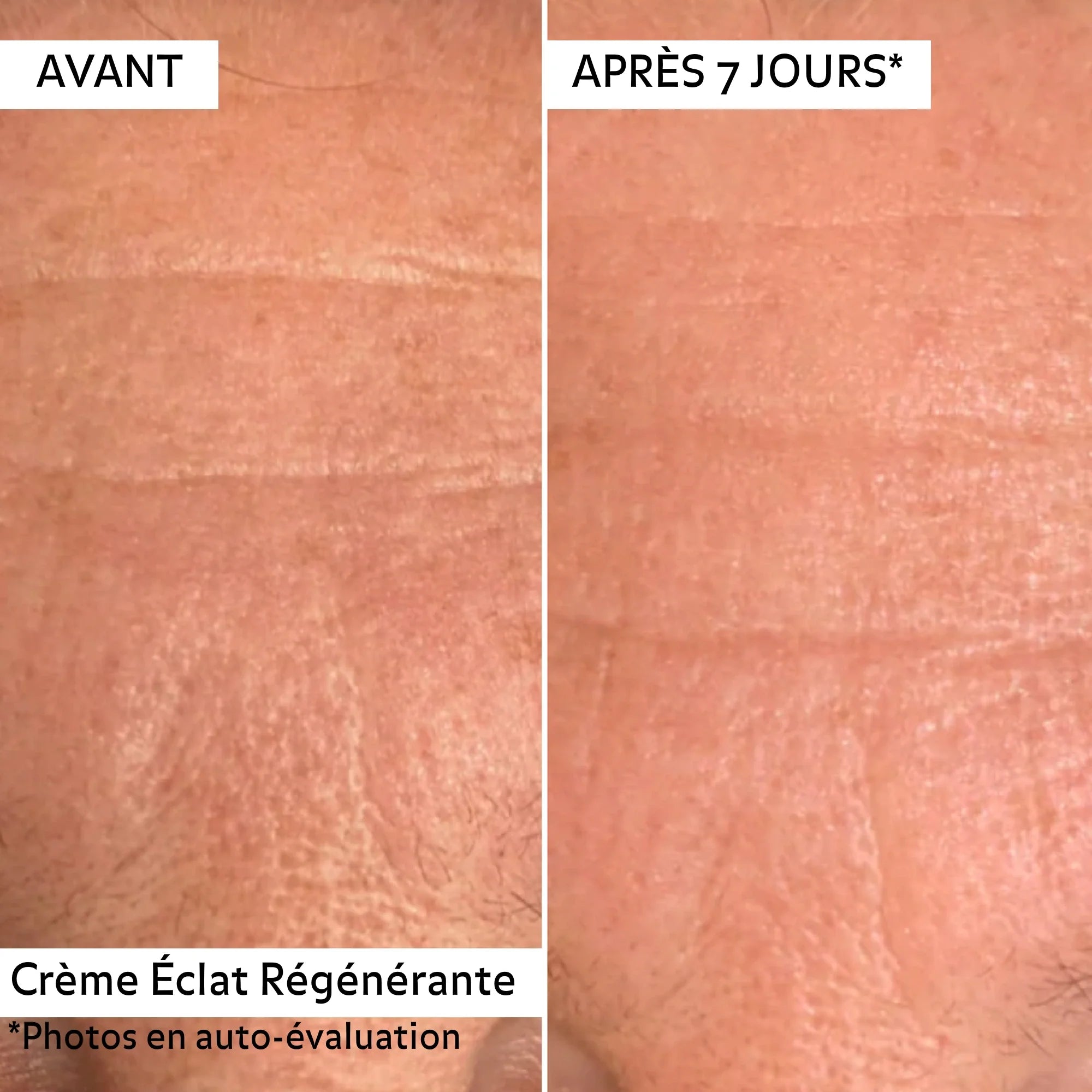 Duo Éclat Régénérant