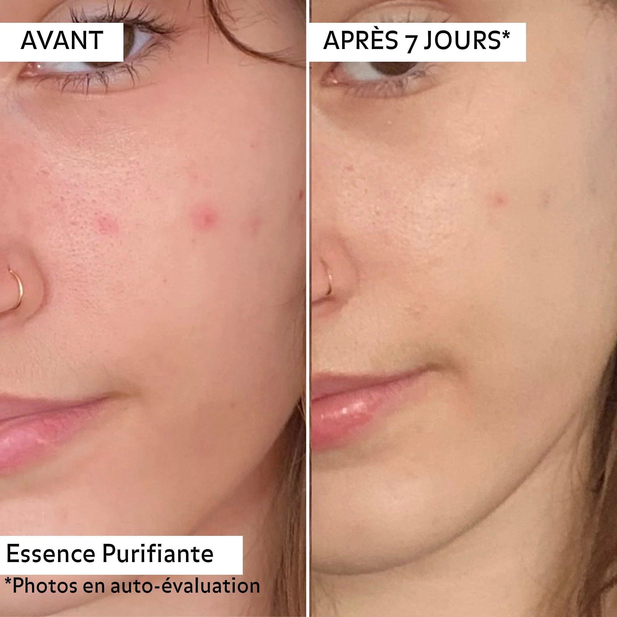 Protocole SOIN RESET + Booster Purifiant