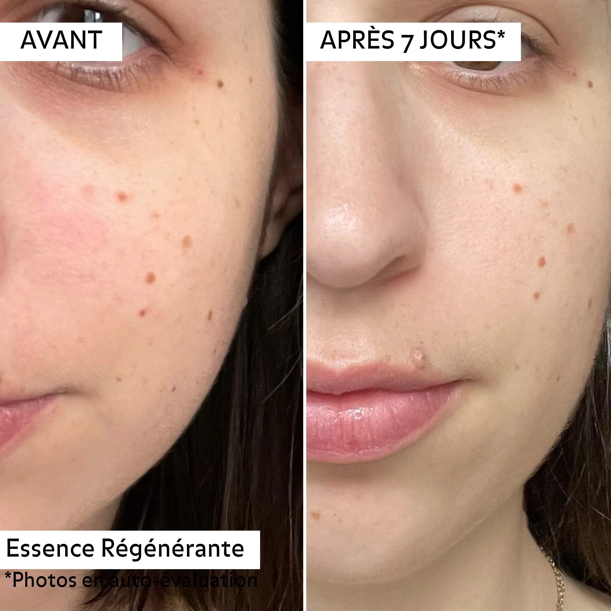 Essence Régénérante