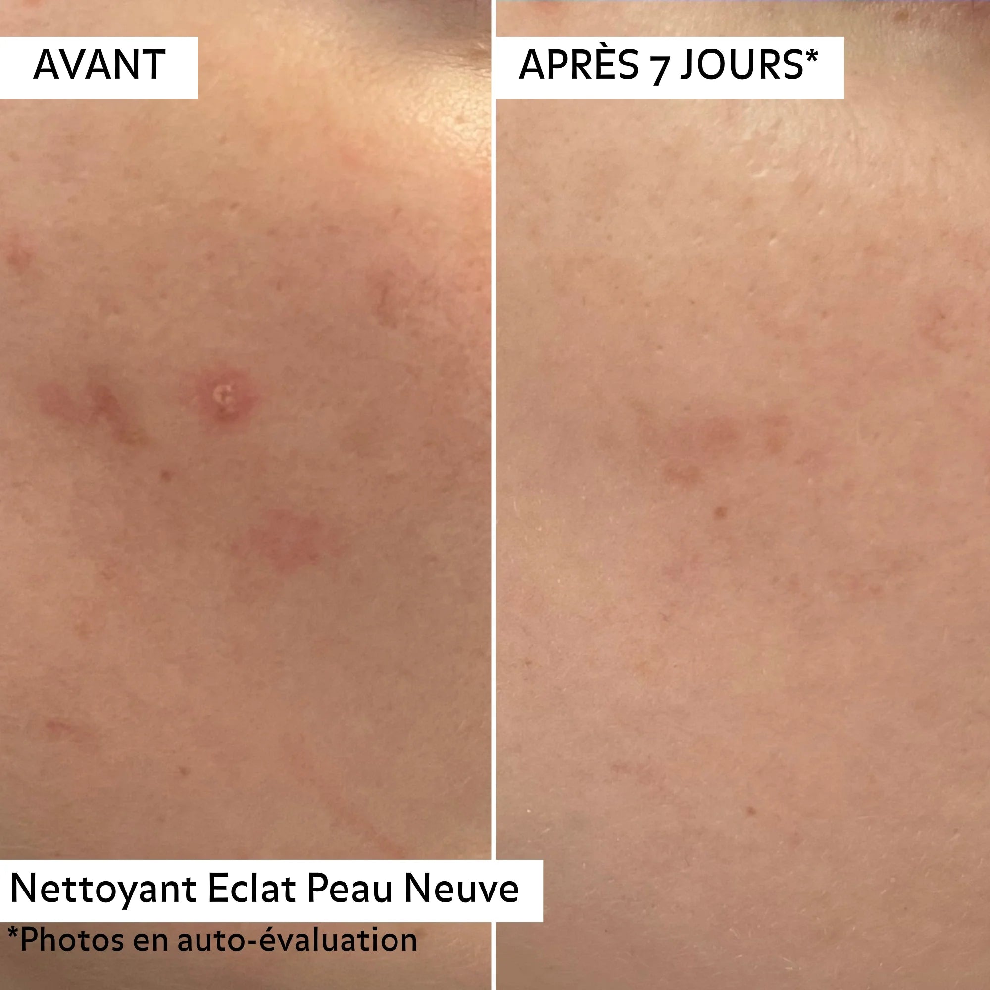 Duo Nettoyant Éclat Peau Neuve