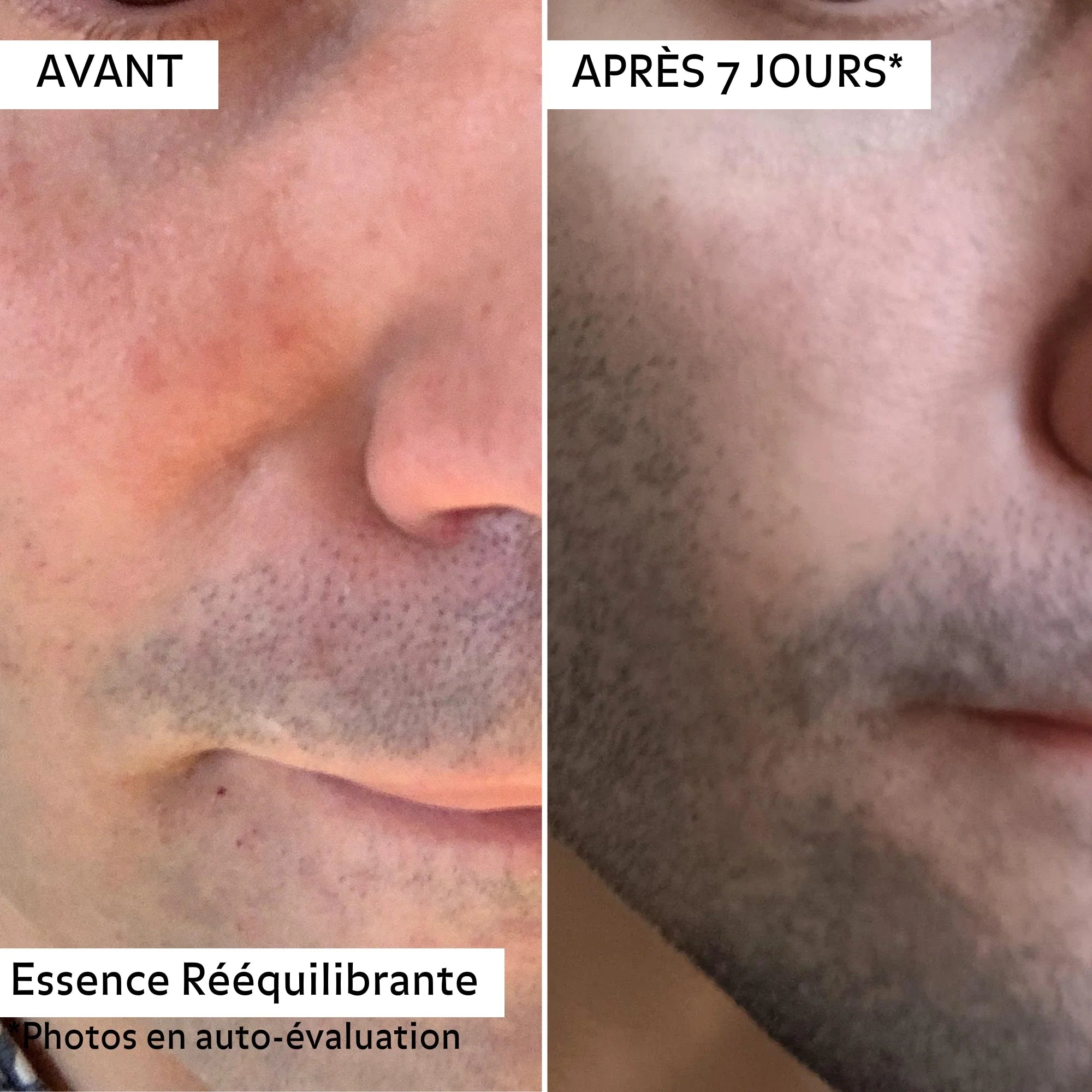 Essence Rééquilibrante
