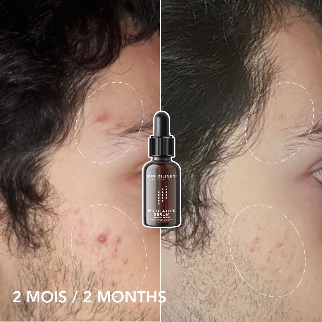 SERUM REGULATION 15ml