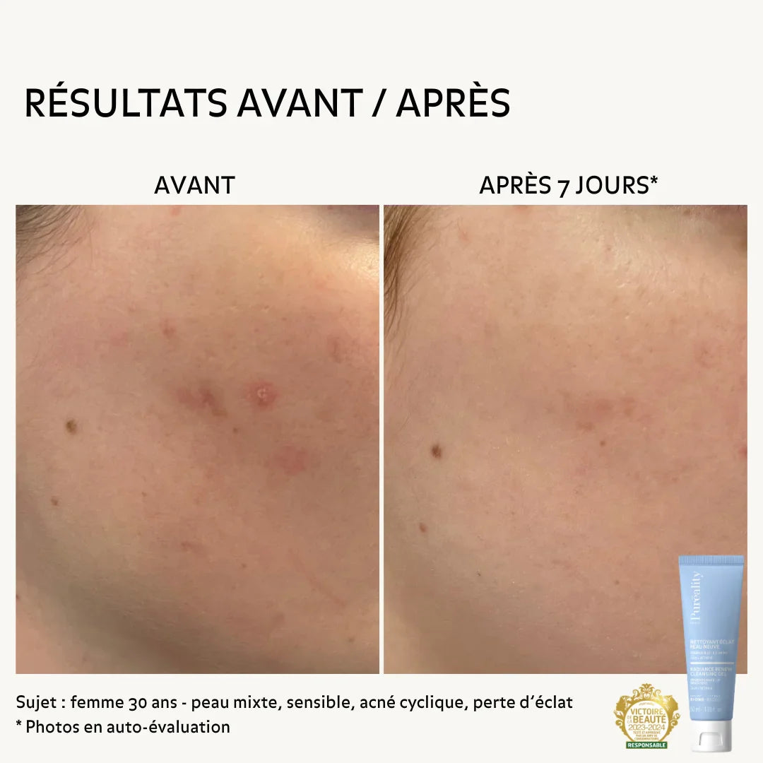 Nettoyant Éclat Peau Neuve