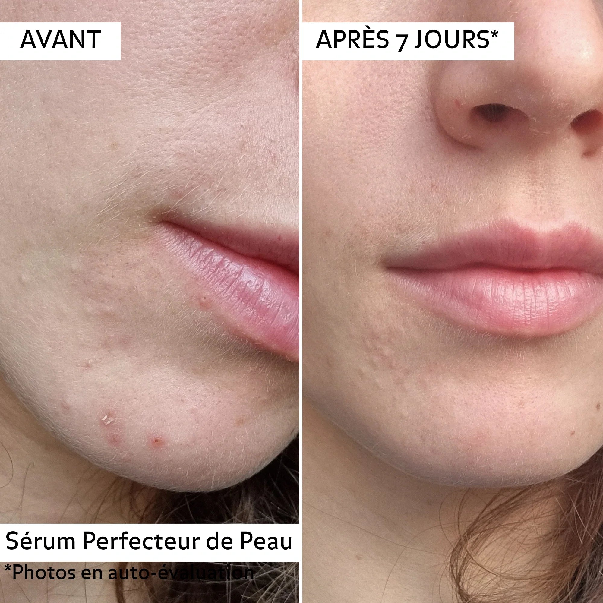 Sérum Perfecteur de Peau