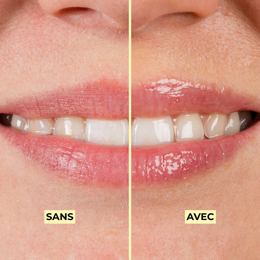 Gloss à lèvres booster d'hydratation