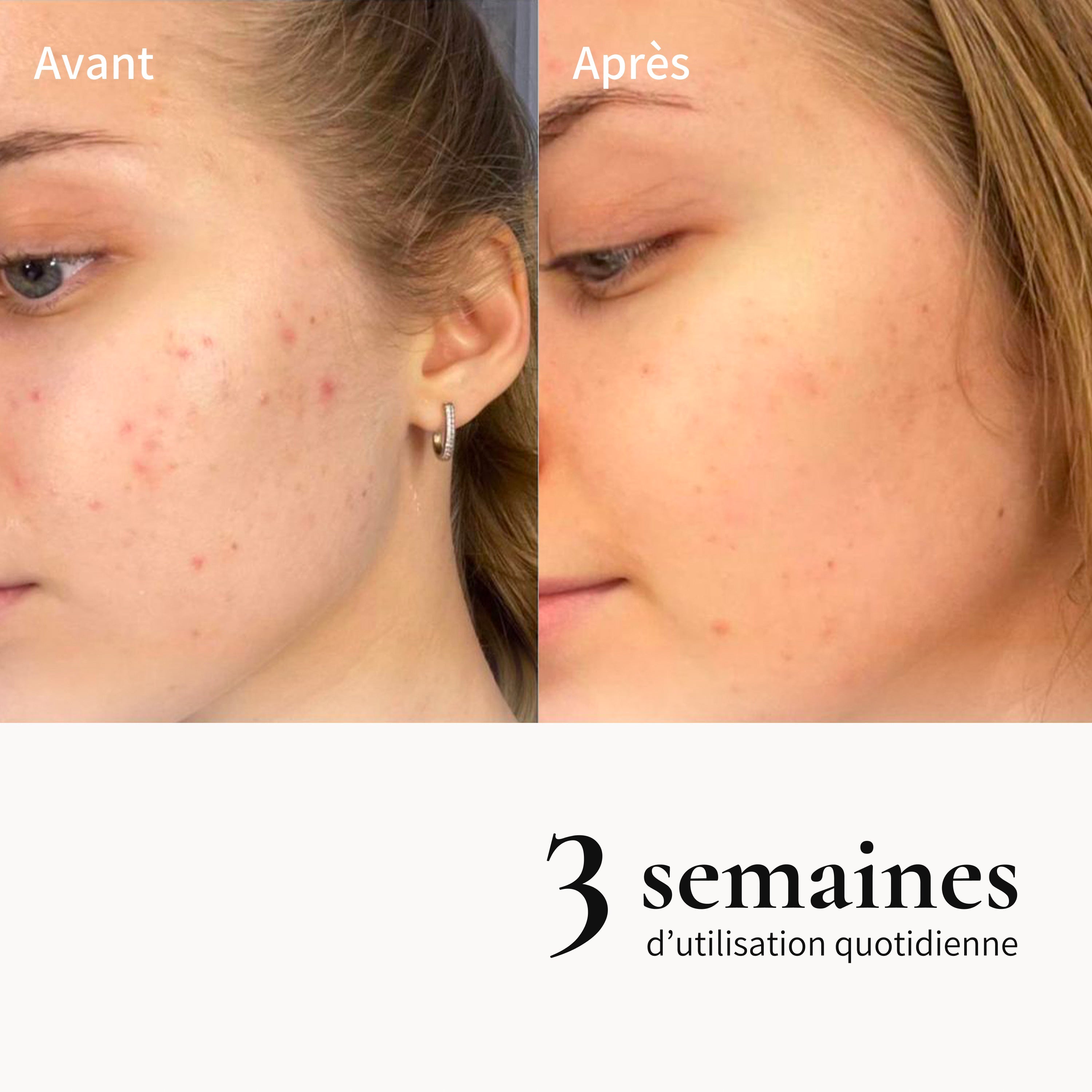 Huile métamorphose démaquillante réconfortante