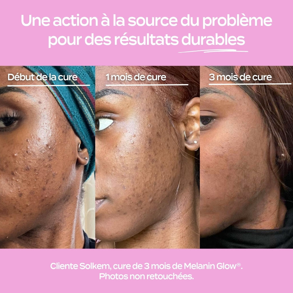 Melanin Glow