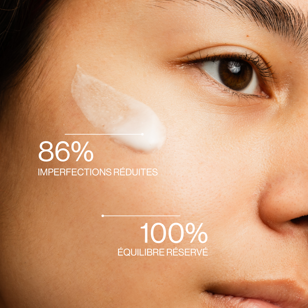 Crème anti-imperfections
