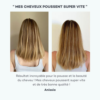 Complexe de Pousse