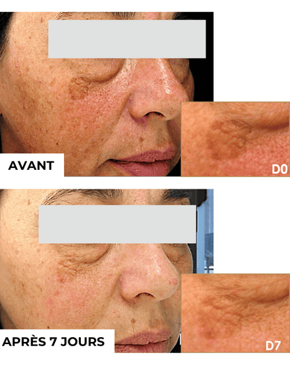 SOIN CONTOUR DES YEUX INTENSE