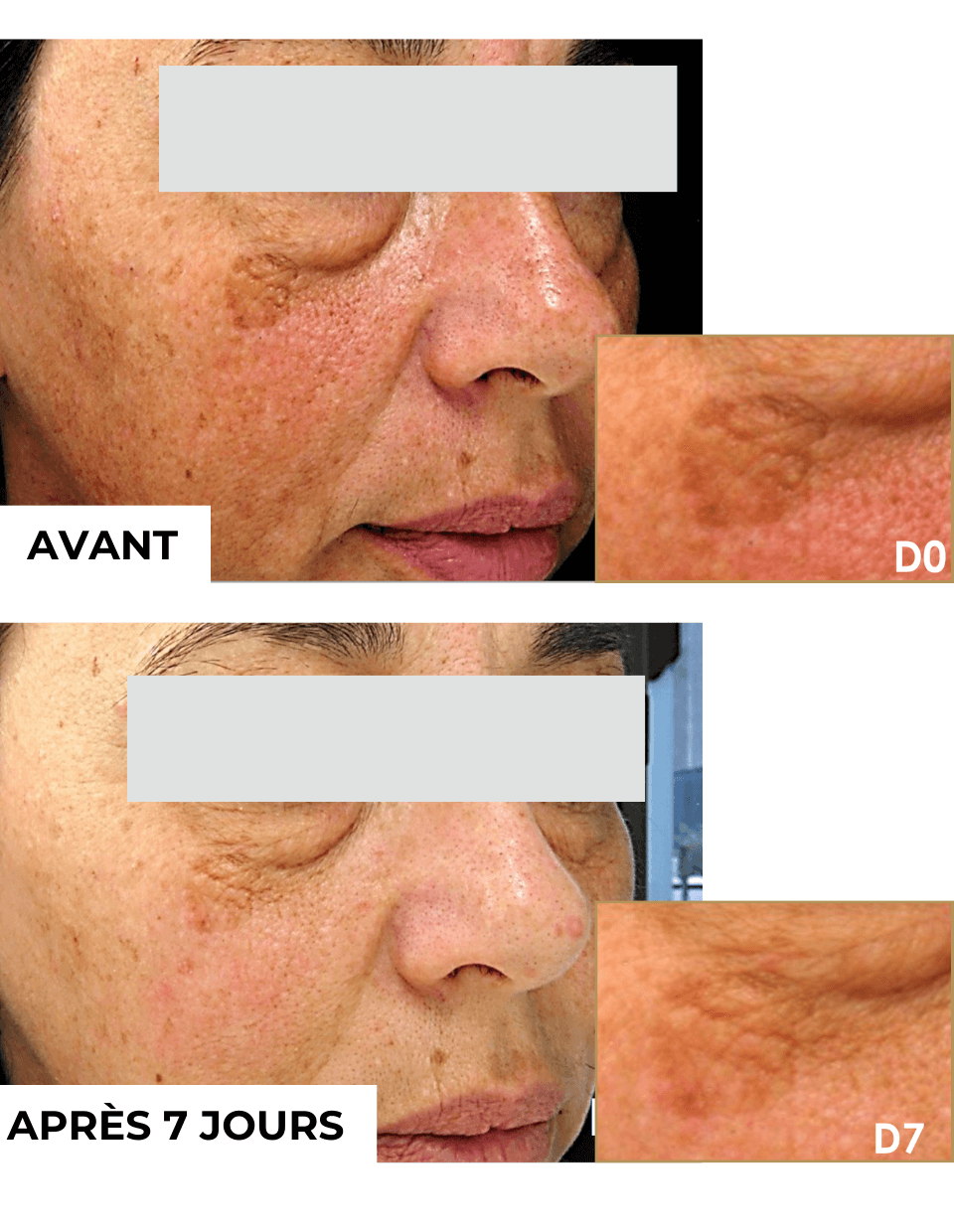 SOIN CONTOUR DES YEUX INTENSE