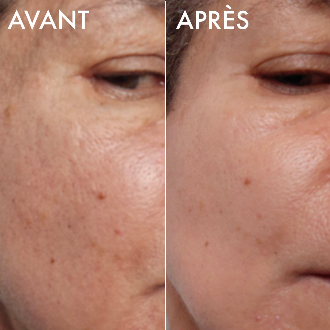 Voile Lacté - 30ml
