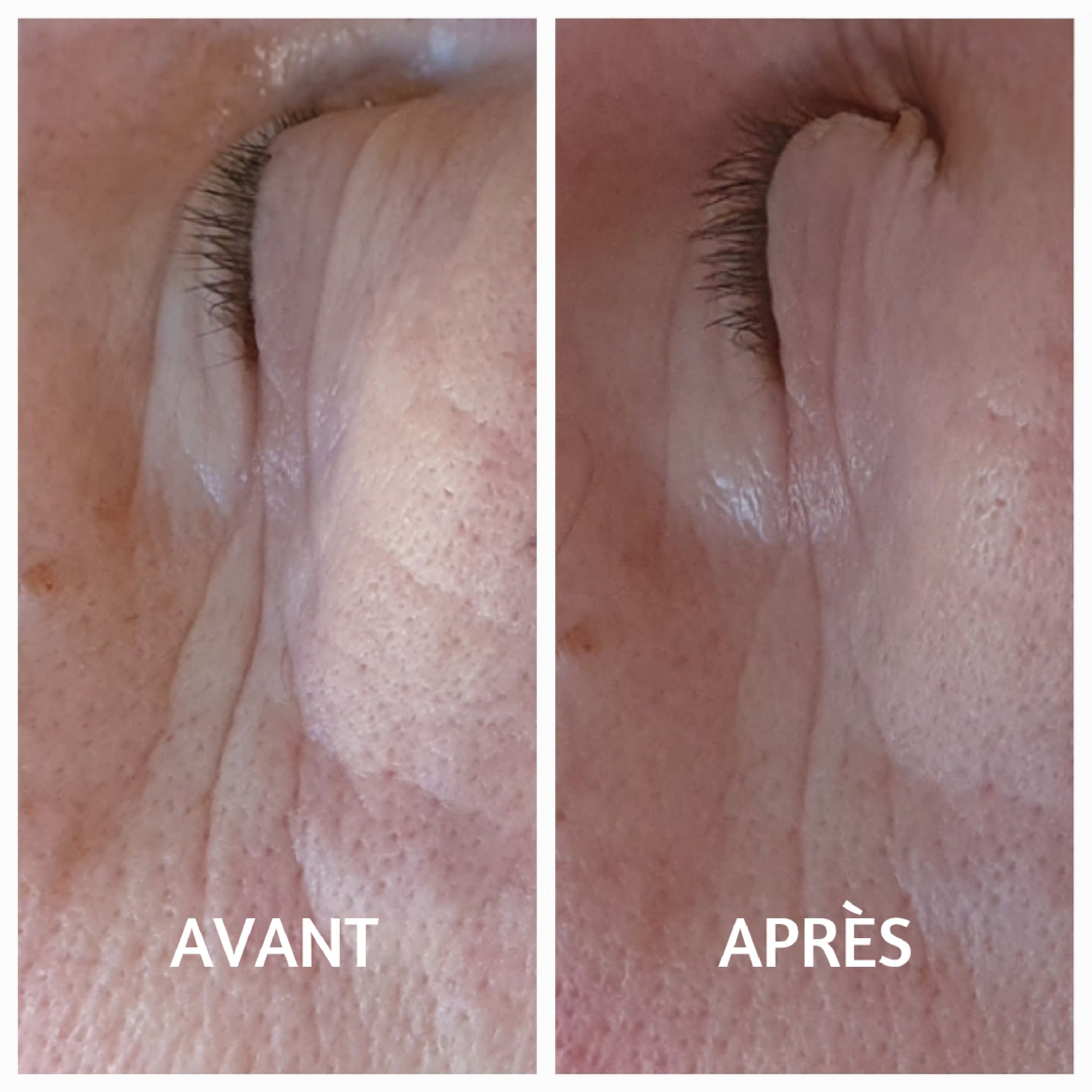 Cure intensive Contour des Yeux (7 Patchs Yeux)