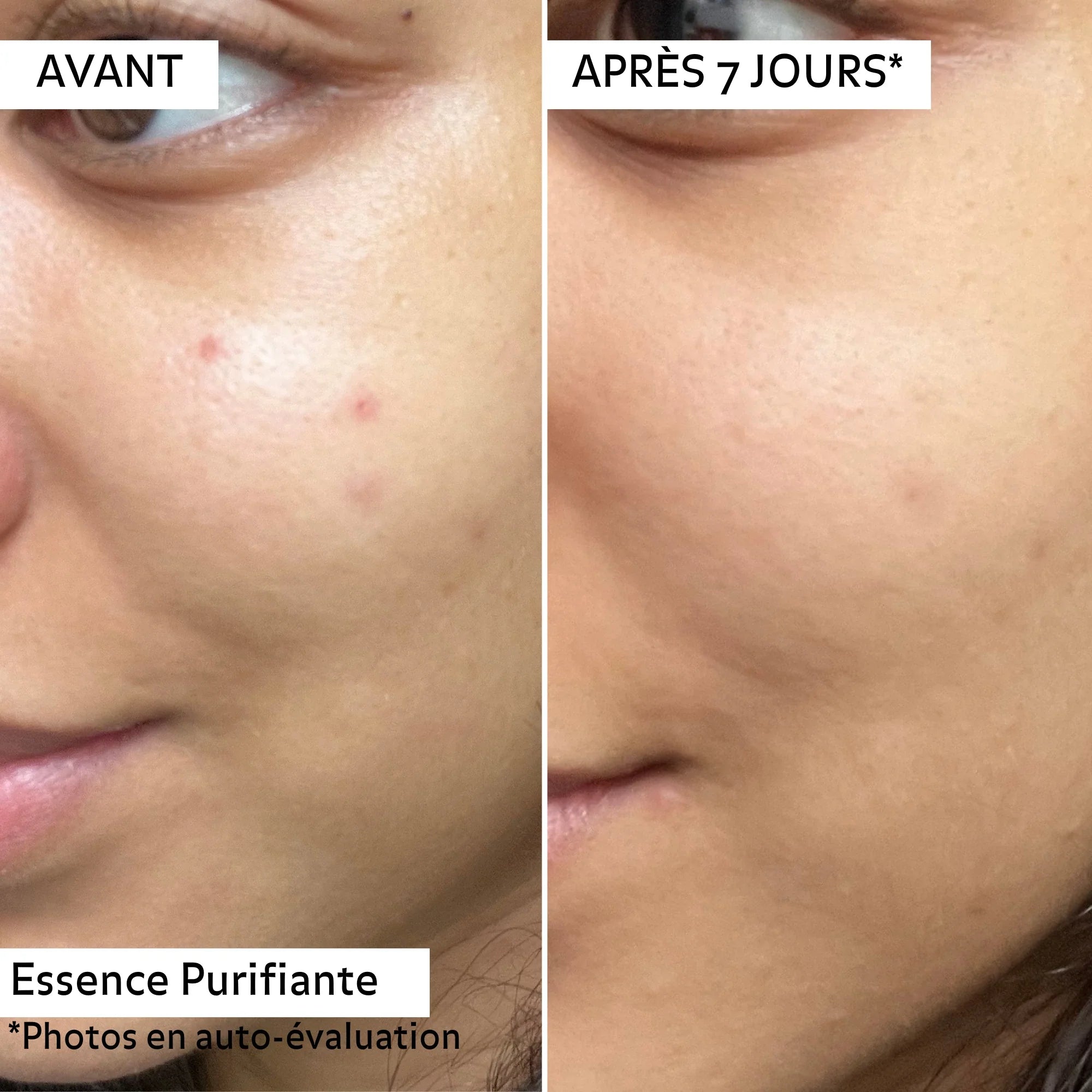 Essence Purifiante