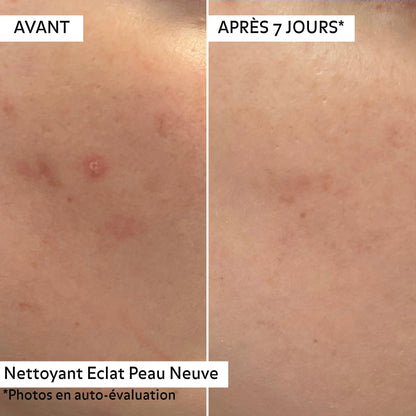 Duo Nettoyant Éclat Peau Neuve
