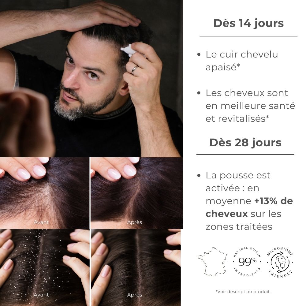 Sérum fortifiant à la soie – Cuir chevelu – Cure 1 Mois [10x5ml] | Anti-chute et repousse – SILKBIOTIC