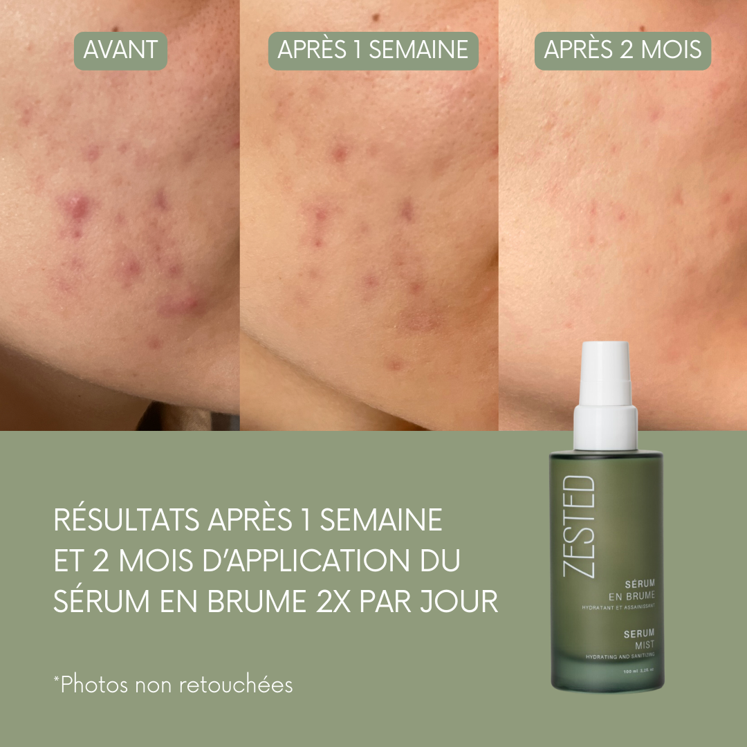 SÉRUM EN BRUME RÉGÉNÉRANT 100ml