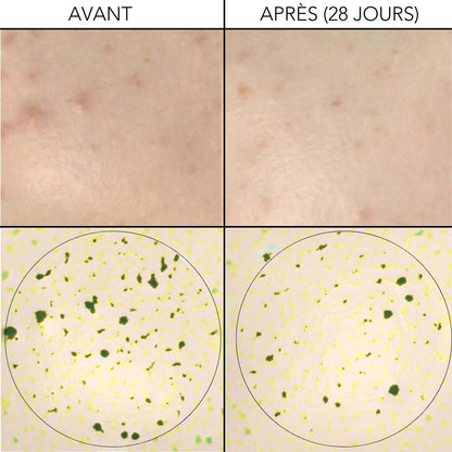SERUM REGULATION 30ml