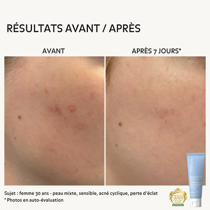 Nettoyant Éclat Peau Neuve