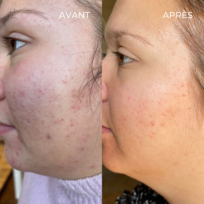 Le sérum anti-imperfections