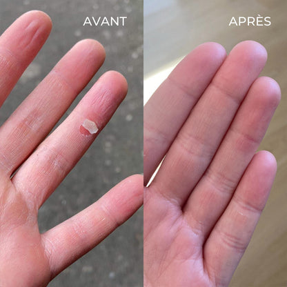Le baume SOS multi-usages