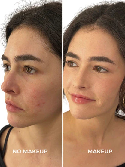 Pack teint parfait - peau medium