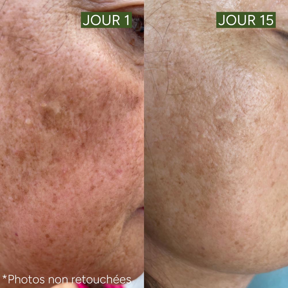 Le sérum unifiant anti-taches