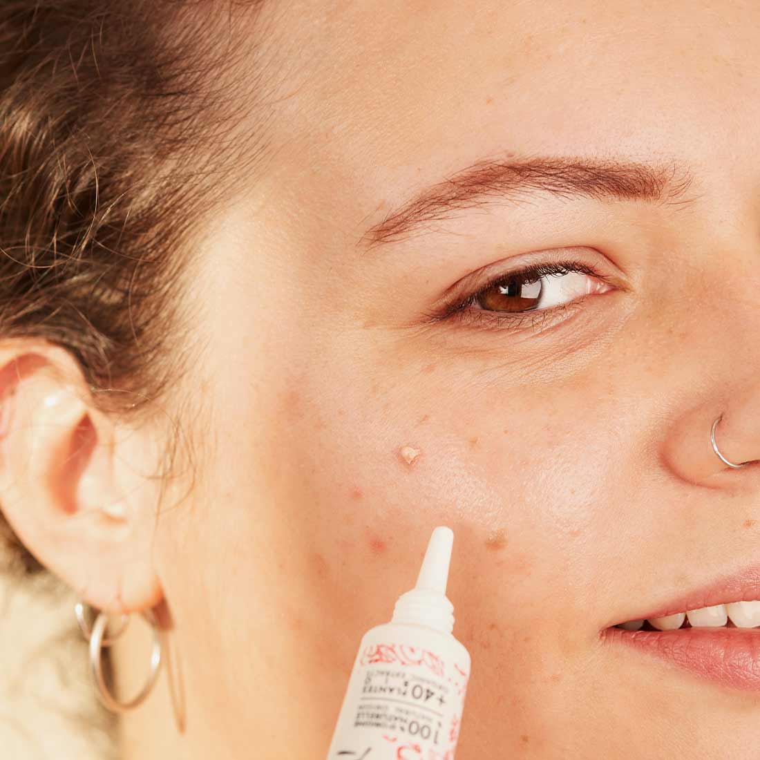 Le soin ciblé SOS boutons